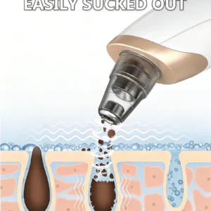 Blackhead Remover Pore Cleaner Black Dots Vacuum Cleaner Skin Pimple Acne Extractor Facial Cleaning Electric Black Head Removal — image 4